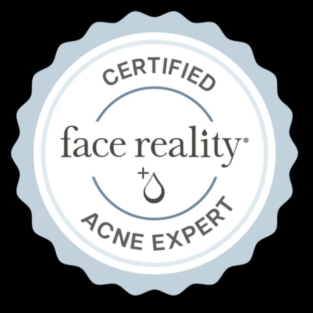 Acne Facial Package at Milagro Beauty Bar in Plymouth, MI
