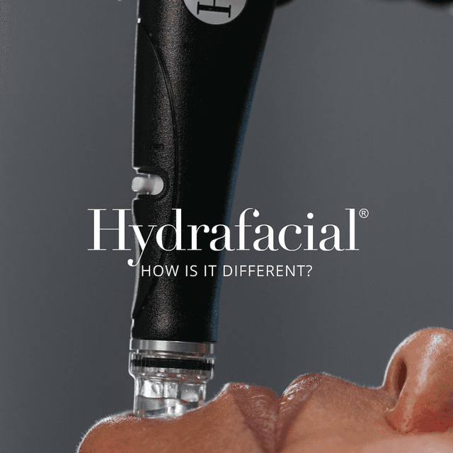 HydraFacial Deluxe at Milagro Beauty Bar in Plymouth, MI